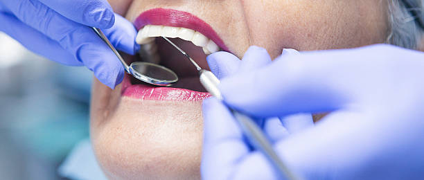Best Dental Abscess Treatment in Cannelton, IN
